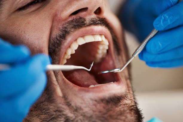 Best Emergency Dental Care for Sports Injuries in Ranger, TX
